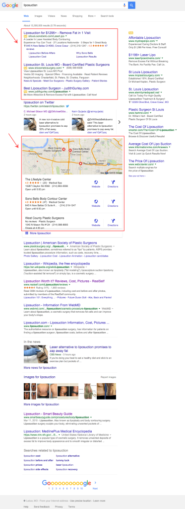 Google SERP of Local SEO marketing liposuction 